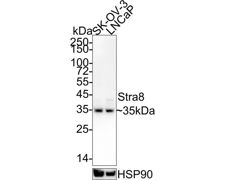 STRA8 Antibody (PSH04-55)