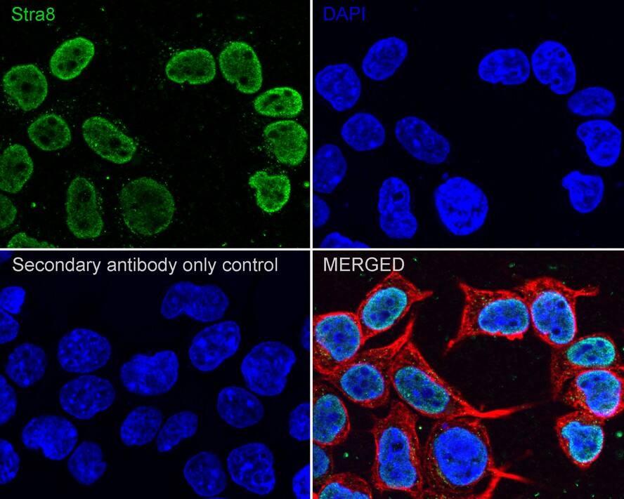 STRA8 Antibody (PSH04-55)