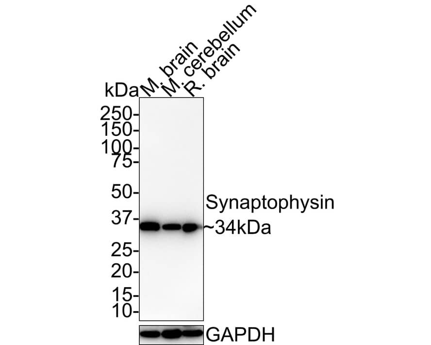 Synaptophysin Antibody (JE42-51)