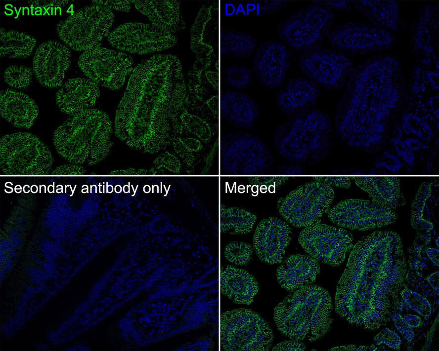 Syntaxin 4 Antibody (PSH0-80)