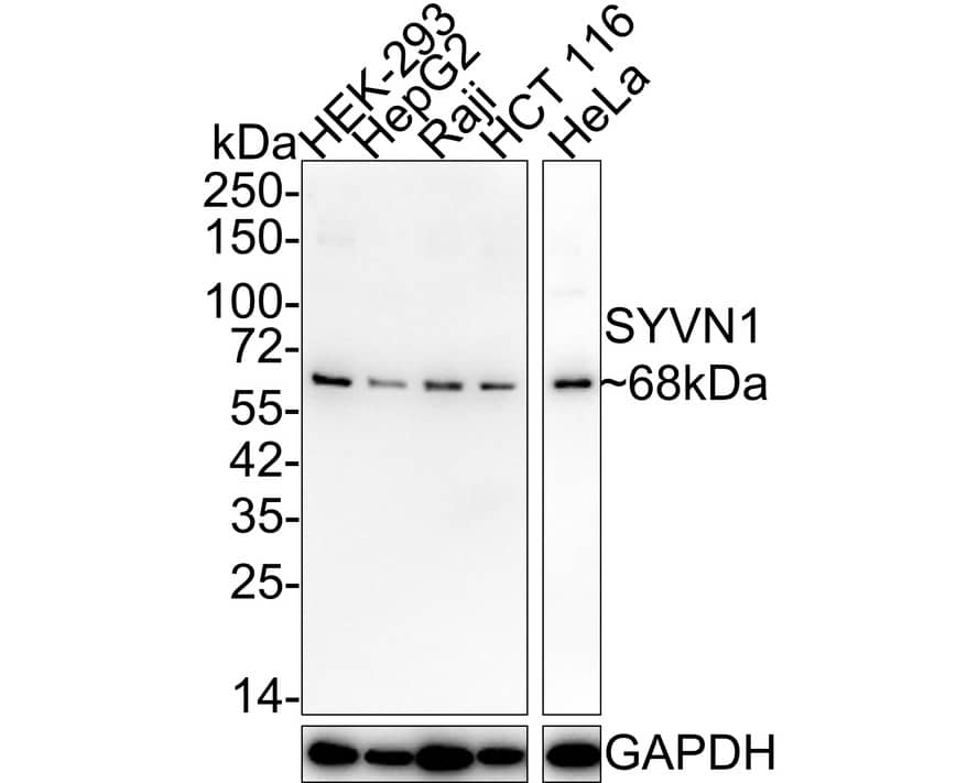 HRD1 Antibody (JE44-67)