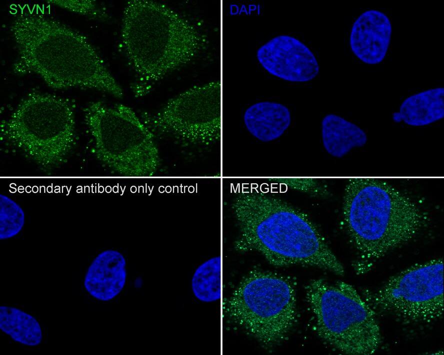 HRD1 Antibody (JE44-67)
