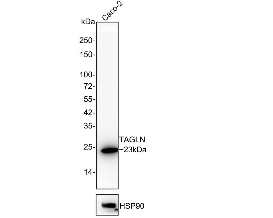 Transgelin/TAGLN/SM22 alpha Antibody (JE60-72)