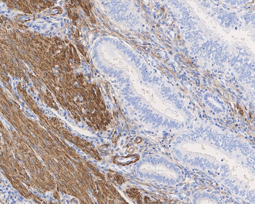 Transgelin/TAGLN/SM22 alpha Antibody (JE60-72)