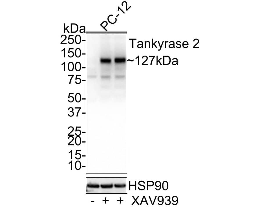 TNKS2 Antibody (PSH0-53)