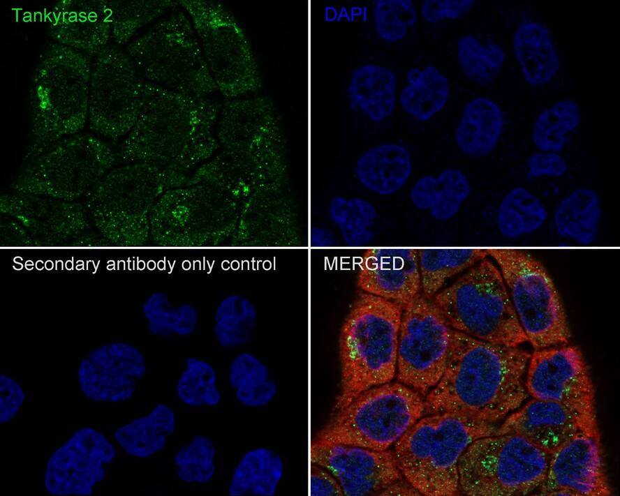 TNKS2 Antibody (PSH0-53)