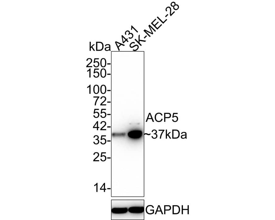 TRACP/PAP/ACP5 Antibody (JE35-95)