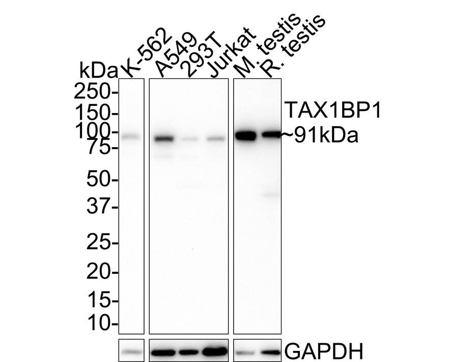 TAX1BP1 Antibody (JE34-80)