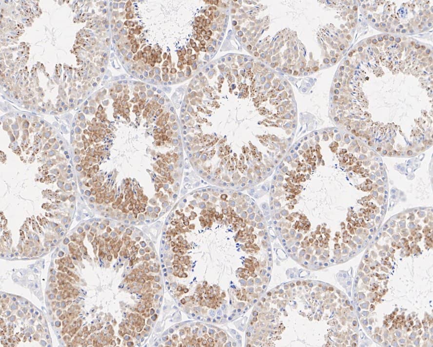 TAX1BP1 Antibody (JE34-80)