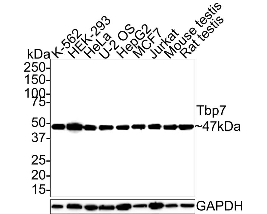 Tbp7 Antibody (JE62-72)