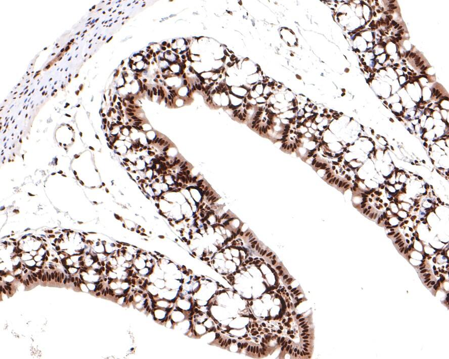 TCEA1 Antibody (JE64-90)