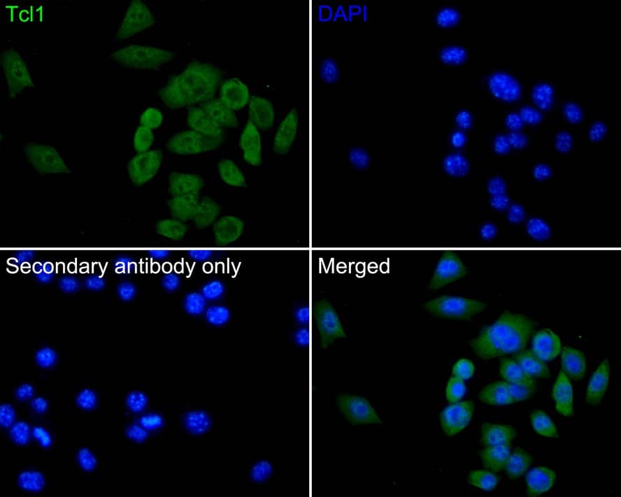 TCL1A Antibody (PD00-94)