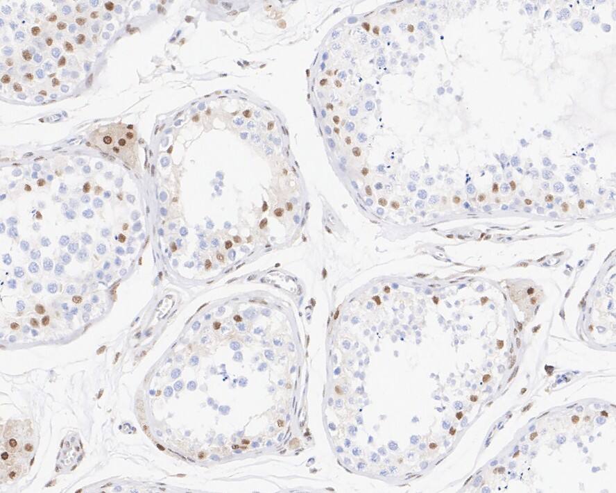 Transcription factor E3 Antibody (JE60-60)