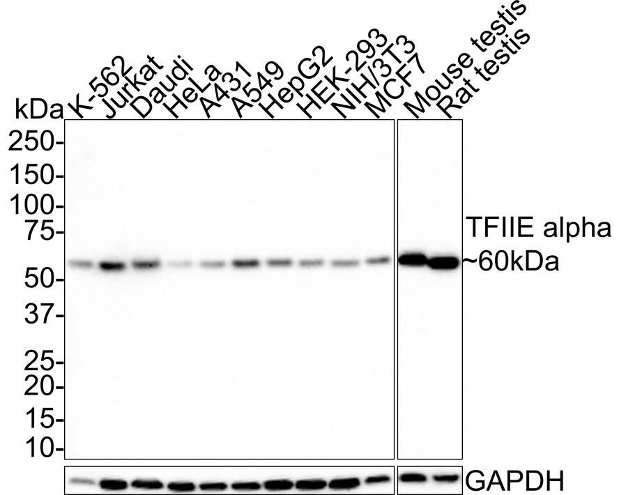 TFIIE-alpha Antibody (JE66-41)