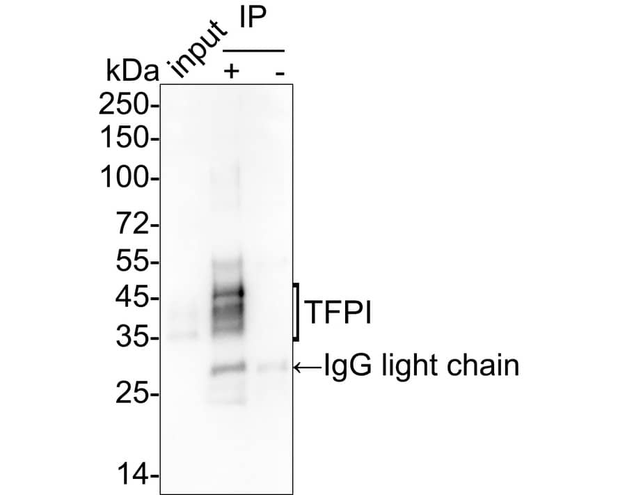 TFPI Antibody (JE40-58)