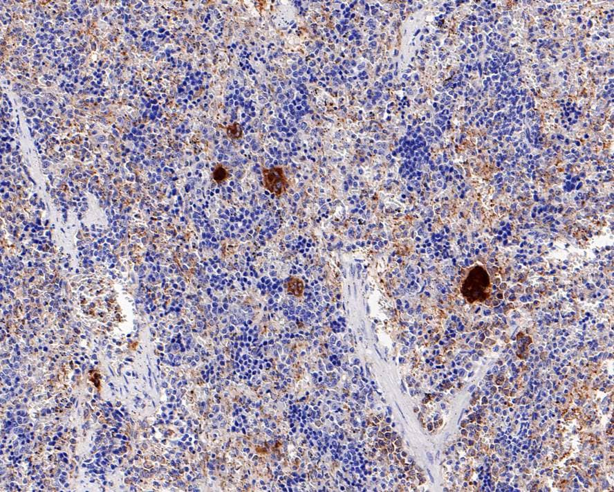 TGF-beta 1 Antibody (PD00-17)
