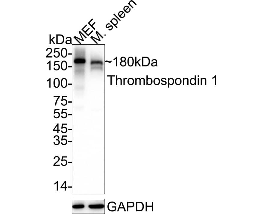 Thrombospondin-1 Antibody (PSH02-97) Western Blot: Thrombospondin-1 Antibody (PSH02-97) [NBP3-33012]