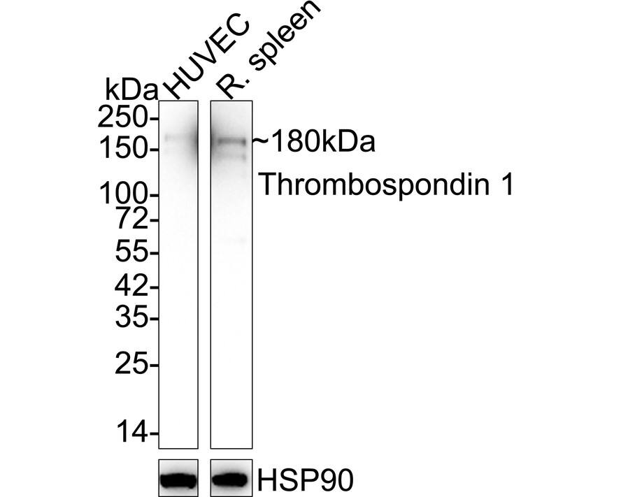 Thrombospondin-1 Antibody (PSH02-97) Western Blot: Thrombospondin-1 Antibody (PSH02-97) [NBP3-33012]