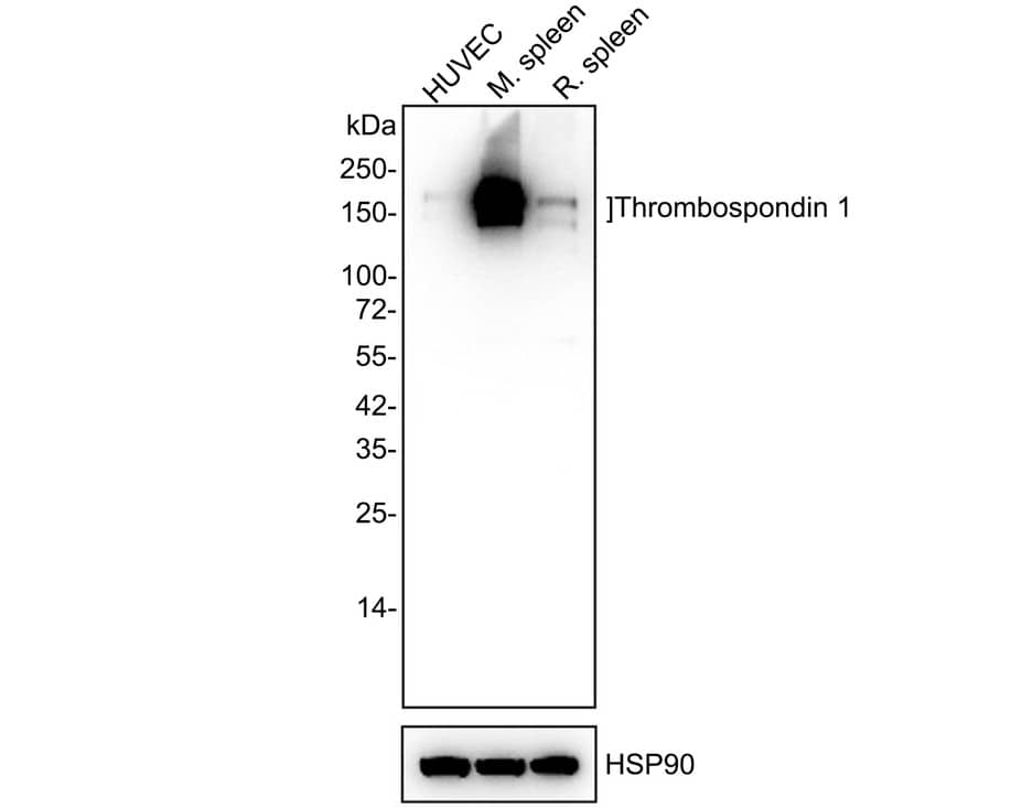 Thrombospondin-1 Antibody (PSH02-97)