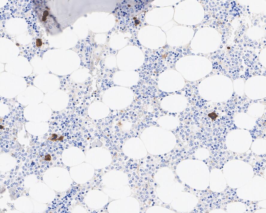 Thrombospondin-1 Antibody (PSH02-97)