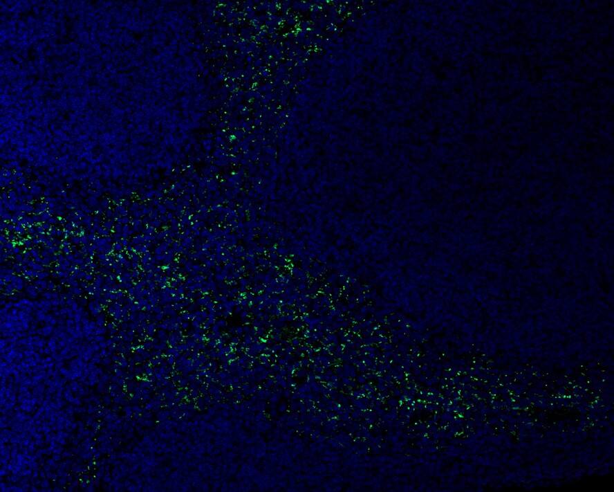 Thrombospondin-1 Antibody (PSH02-97)