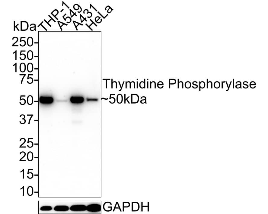 PD-ECGF/Thymidine Phosphorylase Antibody (A1A10-R)