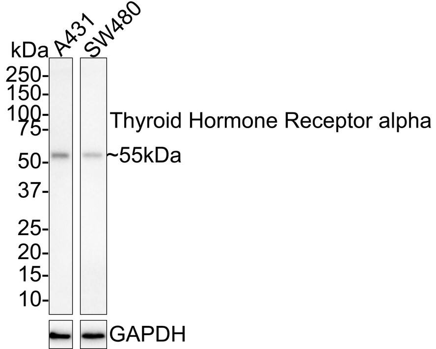 TR alpha/NR1A1/Thyroid Hormone Receptor alpha Antibody (JE40-49) Western Blot: TR alpha/NR1A1/Thyroid Hormone Receptor alpha Antibody (JE40-49) [NBP3-33015]