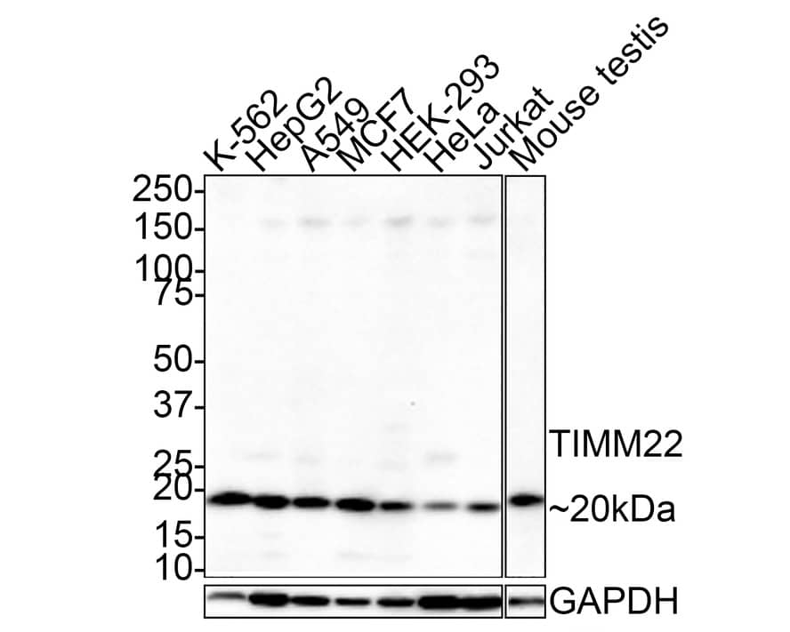 TIMM22 Antibody (JE66-67)