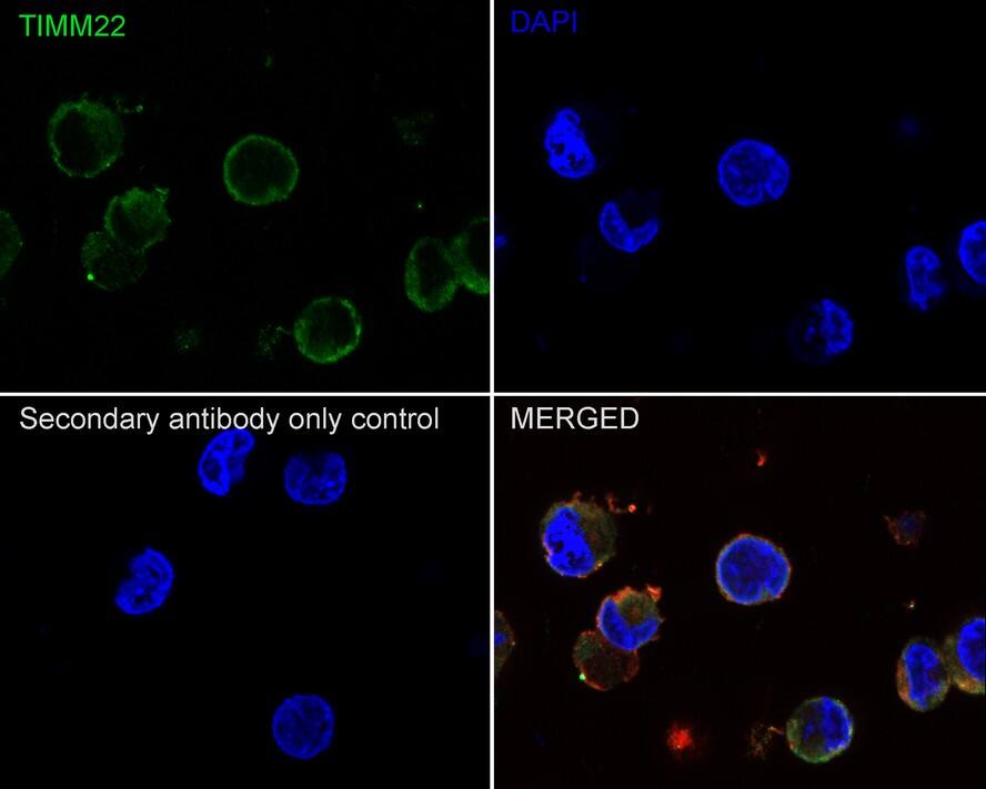 TIMM22 Antibody (JE66-67)