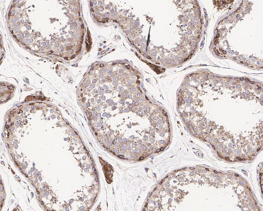 TIMM22 Antibody (JE66-67)