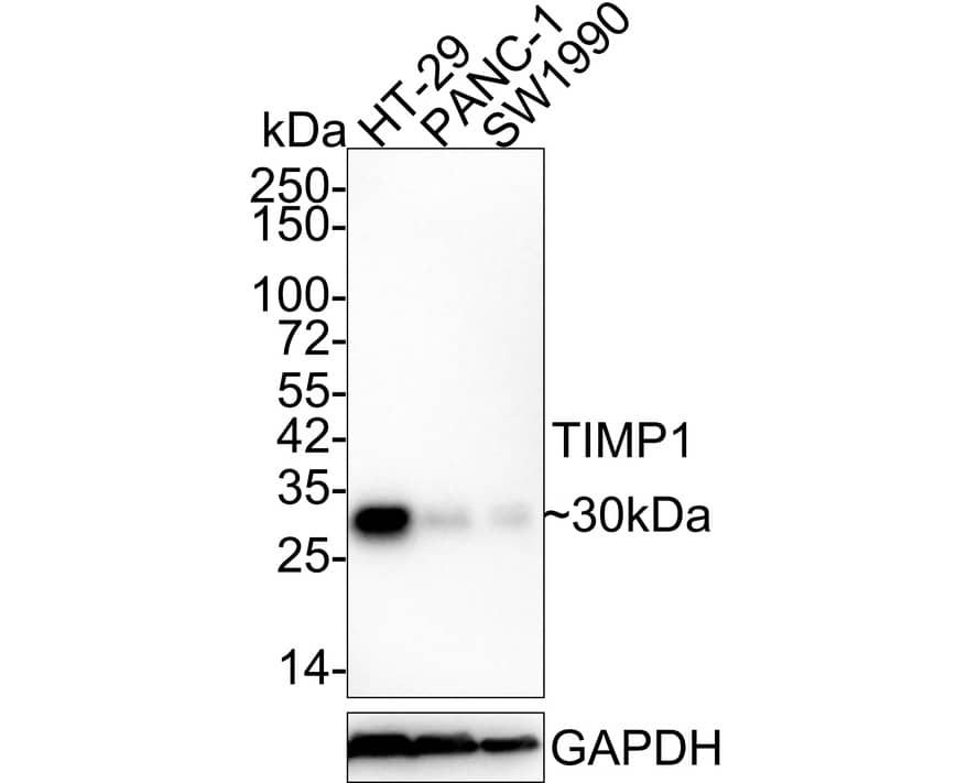 TIMP-1 Antibody (JE59-72)