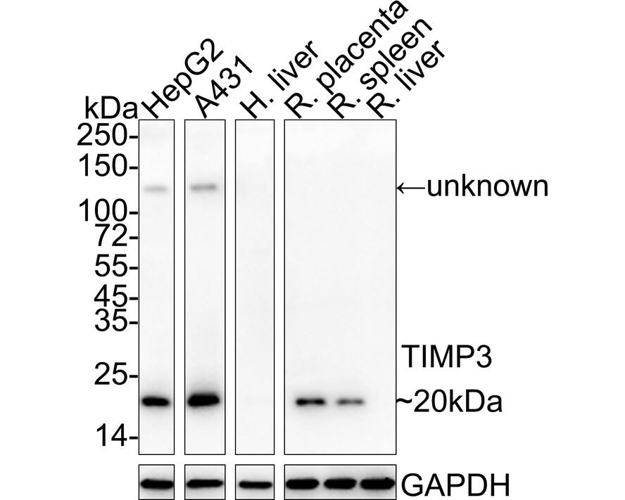 TIMP-3 Antibody (PSH04-41)