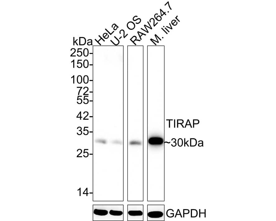 TIRAP Antibody (JE46-35) Western Blot: TIRAP Antibody (JE46-35) [NBP3-33024]