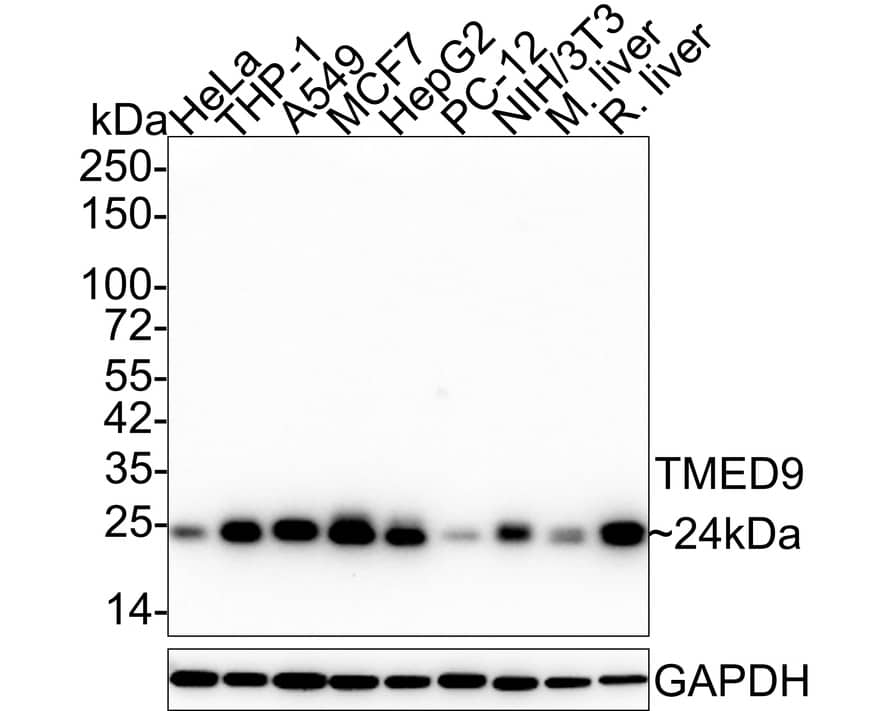 TMED9 Antibody (A9A8)