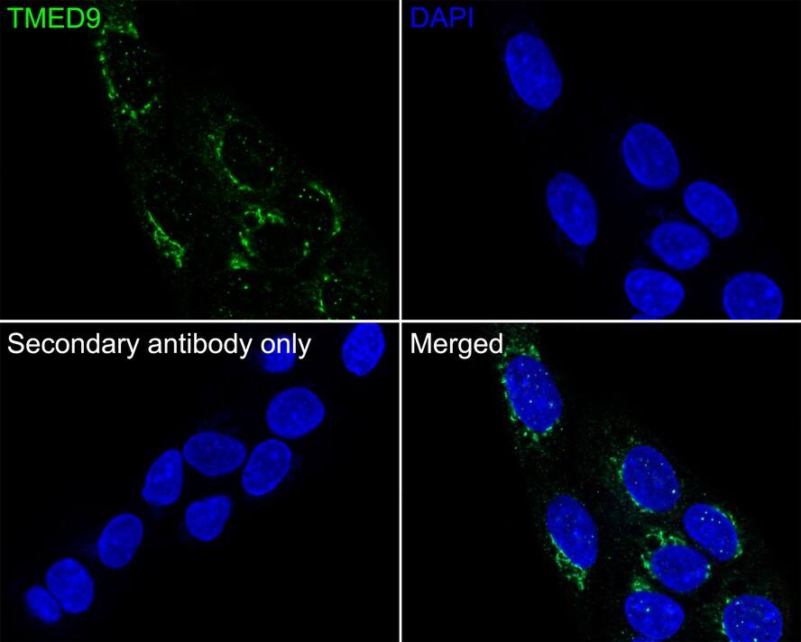 TMED9 Antibody (A9A8)