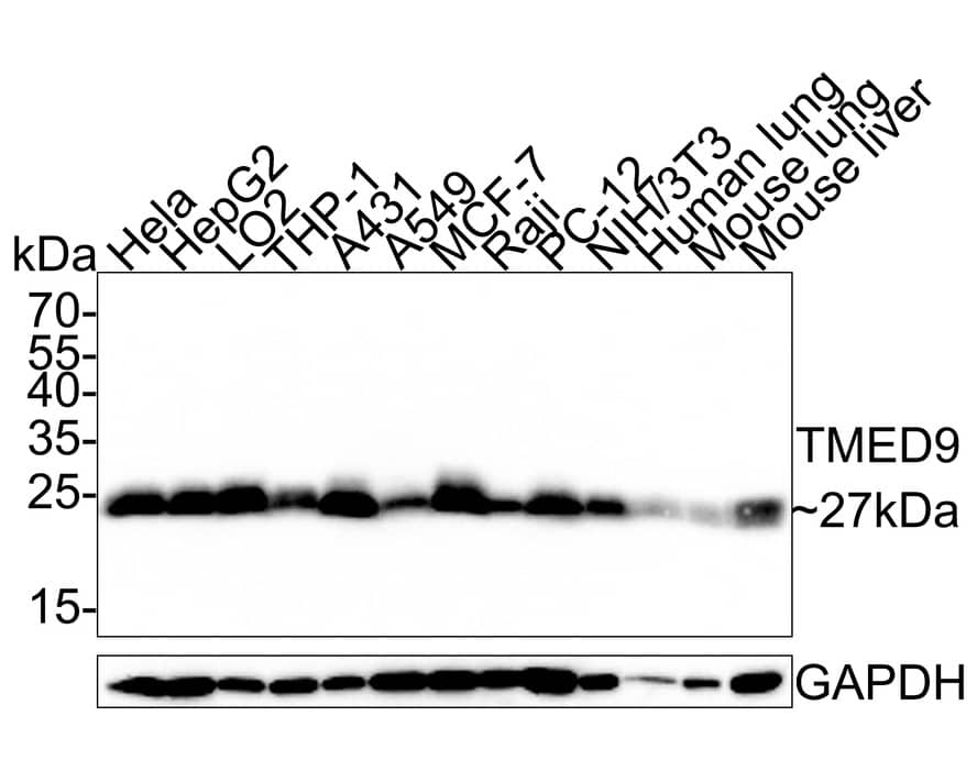 TMED9 Antibody (A9A7-R)