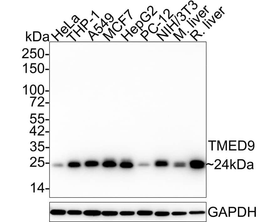 TMED9 Antibody (A9A8-R)