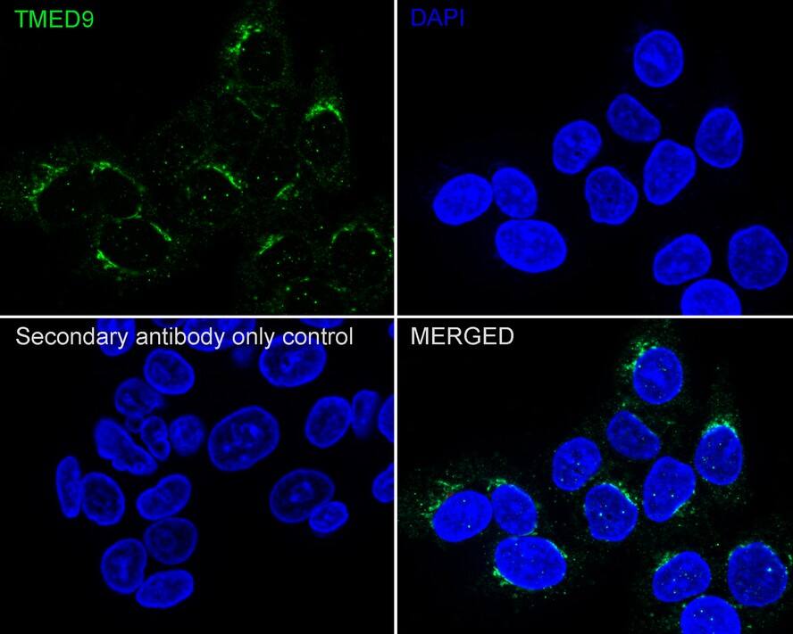 TMED9 Antibody (A9A8-R)