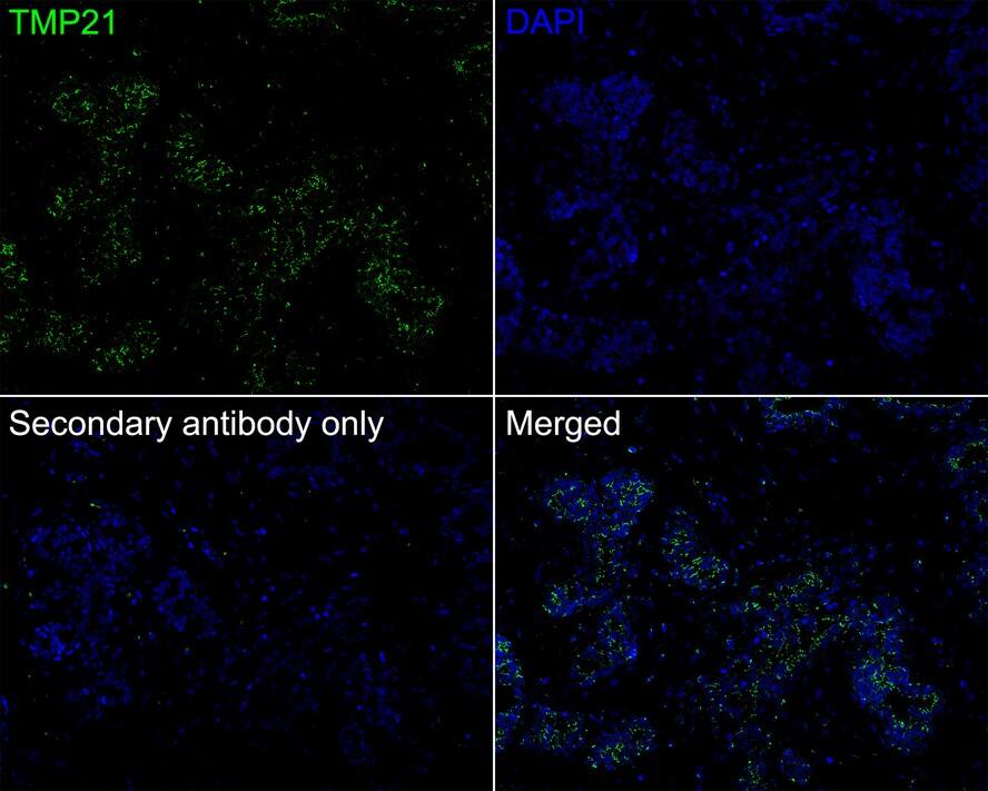 Tmp21/p23 Antibody (PSH01-40)