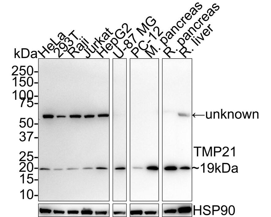Tmp21/p23 Antibody (PSH01-41) Western Blot: Tmp21/p23 Antibody (PSH01-41) [NBP3-33031]