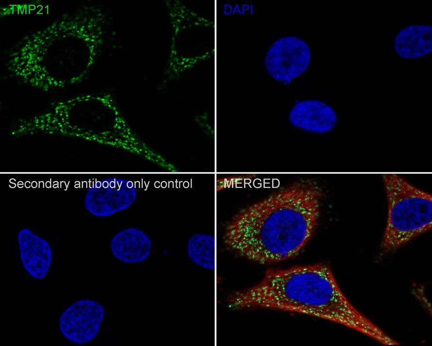 Tmp21/p23 Antibody (PSH01-41)