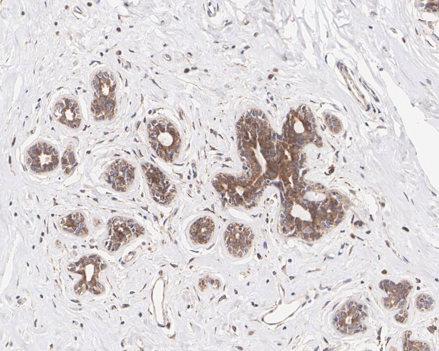 Tmp21/p23 Antibody (PSH01-41)