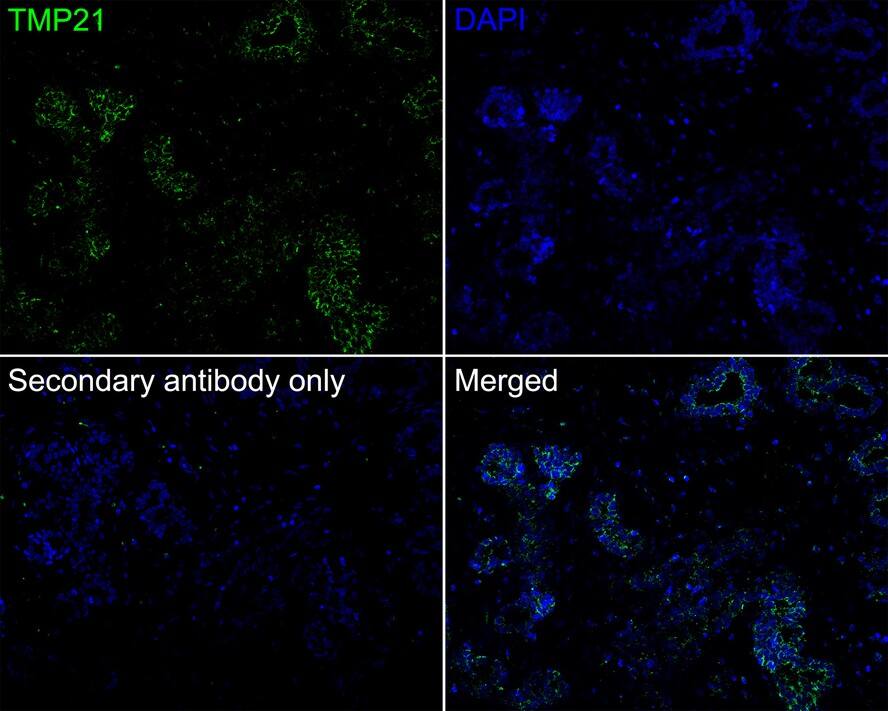 Tmp21/p23 Antibody (PSH01-41)