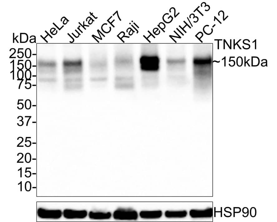 Tankyrase 1 Antibody (PSH0-51)