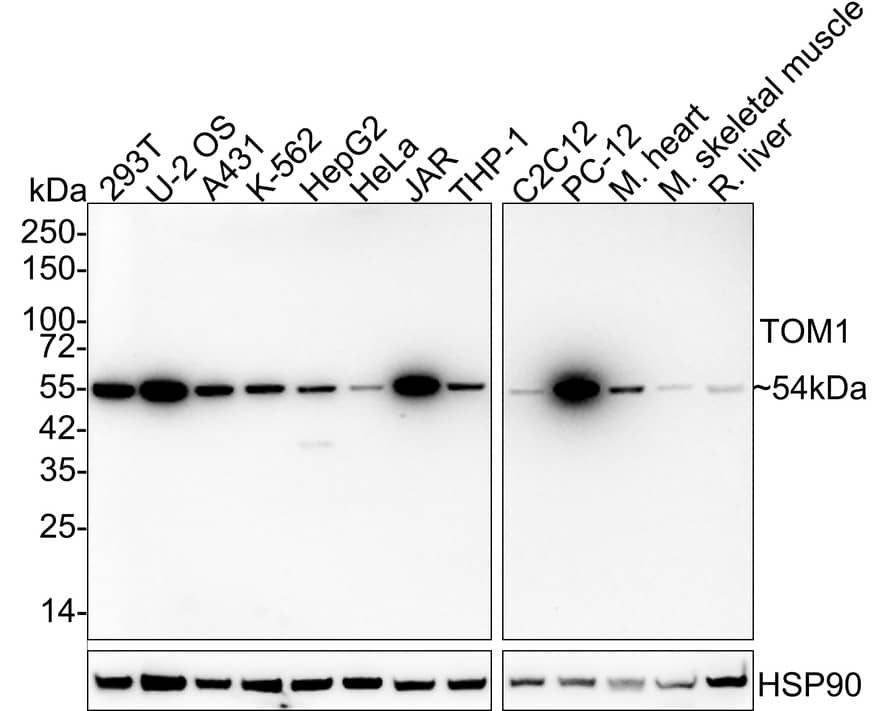 TOM1 Antibody (PSH03-38)