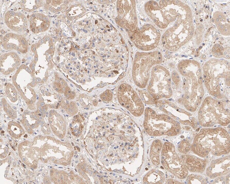 TOM1 Antibody (PSH03-38)