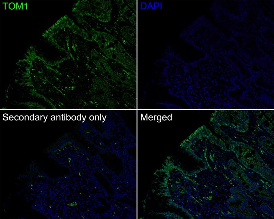 TOM1 Antibody (PSH03-38)