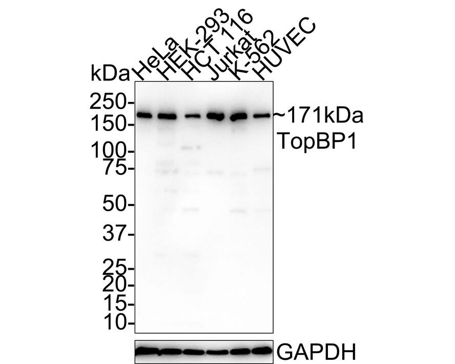 TopBP1 Antibody (PSH01-14)