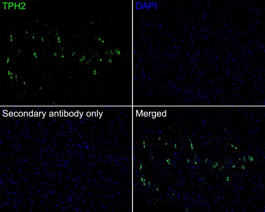 Tryptophan hydroxylase 2 Antibody (PSH04-89)