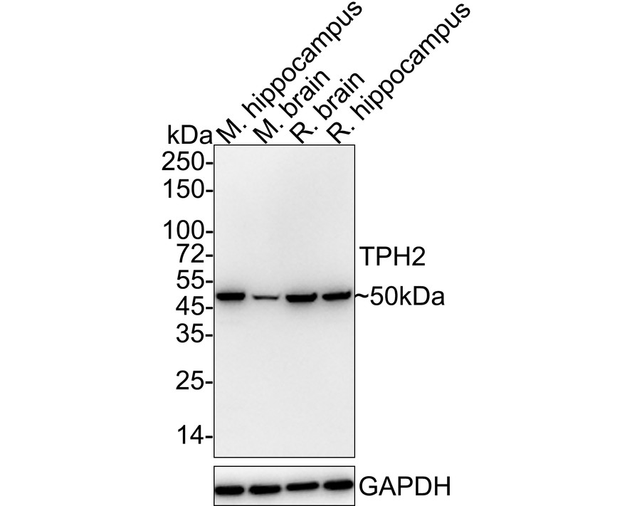 Tryptophan hydroxylase 2 Antibody (PSH04-89)
